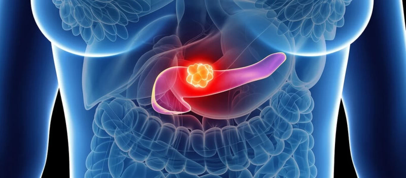 Ποια συμπτώματα δείχνουν προβλήματα στο πάγκρεας; - Μπορεί ένας οδοντίατρος να τα καταλάβει;